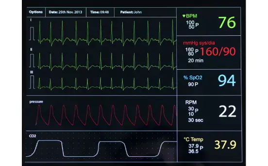 Blood pressure_ECG Screenfill for ThinkPad X12